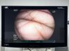 FUJINON Scope Model: EC-600WL Endoscopy Processor