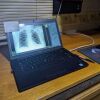 VIEWORKS VIVIX-S 1717V – FXRD-1717VB Portable X-Ray