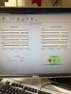 LUNAR Prodigy Advance P7 Bone Densitometer