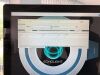 ECHOLIGHT S.P.A. EchoStation Bone Densitometer