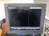 VOLCANO THERAPEUTICS s5r Ultrasound - Vascular - Small Parts