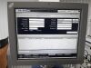 VOLCANO THERAPEUTICS s5r Ultrasound - Vascular - Small Parts