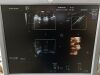 GE Voluson E6 Ultrasound - OB / GYN