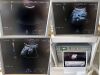 GE Voluson E6 Ultrasound - OB / GYN