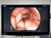 FUJINON Scope Model: EG-530WR Endoscopy Processor