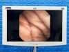 KARL STORZ Storz Scope Model: 11272 VH Endoscopy Processor