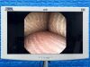 KARL STORZ Storz Scope Model: 11272 VH Endoscopy Processor