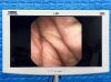 KARL STORZ Storz Scope, Model: 11272VH Endoscopy Processor