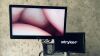 STRYKER 1588HD AIM System with 4K 32" Monitor Display Endoscopy / Laparascopy System