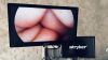 STRYKER 1588HD AIM System with 4K 32" Monitor Display Endoscopy / Laparascopy System
