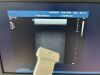 PHILIPS Iu22 Xmatrix Ultrasound - Shared Service