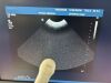 PHILIPS Iu22 Xmatrix Ultrasound - Shared Service