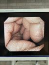 OLYMPUS GIF-H290 Gastroscope