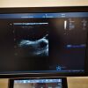GE HEALTHCARE Vivid S60N