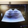 GE HEALTHCARE Logic S7 Expert