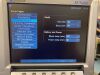 SONOSITE M-Turbo General Ultrasound System
