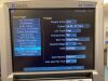 SONOSITE M-Turbo General Ultrasound System