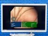 OLYMPUS CV-180/CLV-180 Tower with 2x Endoscopes Endoscope