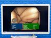 OLYMPUS CV-180/CLV-180 Tower with 2x Endoscopes Endoscope