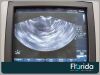 PHILIPS C9-5EC CURVED ULTRASOUND TRANSDUCER PROBE REF 453561232031FOR HD11/ IU22 TESTED Ultrasound Transducer