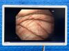 OLYMPUS Scope Model: GIF-H180J Endoscopy Processor