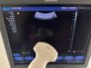 SIEMENS Acuson X300 Premium Edition Ultrasound - OB / GYN - Vascular