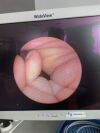 OLYMPUS 30 CYF-4 Endoscope  Leak Tested    Black Dots