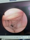 OLYMPUS 30 CYF-4 Endoscope  Leak Tested    Black Dots