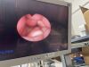OLYMPUS URF Type P3 Ureteroscope