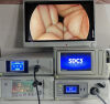 STRYKER 1288 camera X8000 , 40L Insufflator, Pro LED , Telescope And SDC 3