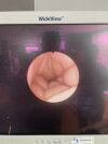 KARL STORZ 11278A1 Endoscope
