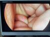 STRYKER 1288-210-105 Arthroscopic Video System