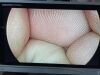 STRYKER 1288-210-105 Arthroscopic Video System