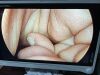 STRYKER 1288-210-105 Arthroscopic Video System