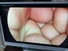 STRYKER 1288-210-105 Arthroscopic Video System