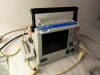 ZOLL M Series Defibrillator