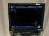 BK MEDICAL PRO FOCUS 2202 Ultrasound - Urology