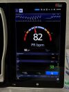MASIMO Root RDS7A Monitor