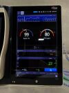MASIMO Root RDS7A Monitor