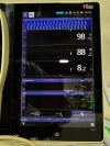 MASIMO Root RDS7A with Radical-7 Monitor