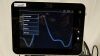 CHEETAH MEDICAL Medical Starling SV Monitor Monitor