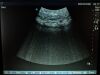 SONOSITE C60/5-2 MHz P04100-01 Ultrasound Transducer