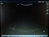 SONOSITE C60/5-2 MHz P04100-01 Ultrasound Transducer