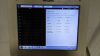 PHILIPS PageWriter TC70 860315 EKG