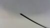 STORZ Various  Coagulating Ball Electrodes | Lot of 4