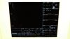 MEDRAD 3010482 Monitor