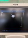 PHILIPS S5-1 Ultrasound Transducer