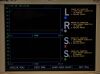 INVOS Oximeter 5100C Monitor