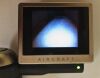 AIRCRAFT MEDICAL McGRATH Series 5 Laryngoscope