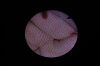 OPTIM ENTity SDXL Otolaryngology